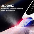 Ultrasonic Skin Scrubber – Electric Facial Skin Care Device