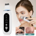 Ultrasonic Skin Scrubber – Electric Facial Skin Care Device