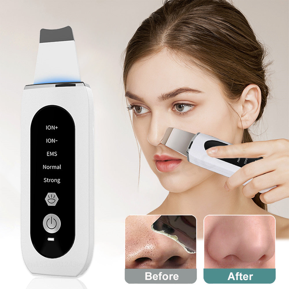 Ultrasonic Skin Scrubber – Electric Facial Skin Care Device