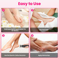 Electric Foot Callus Remover – Rechargeable Foot Care Tool