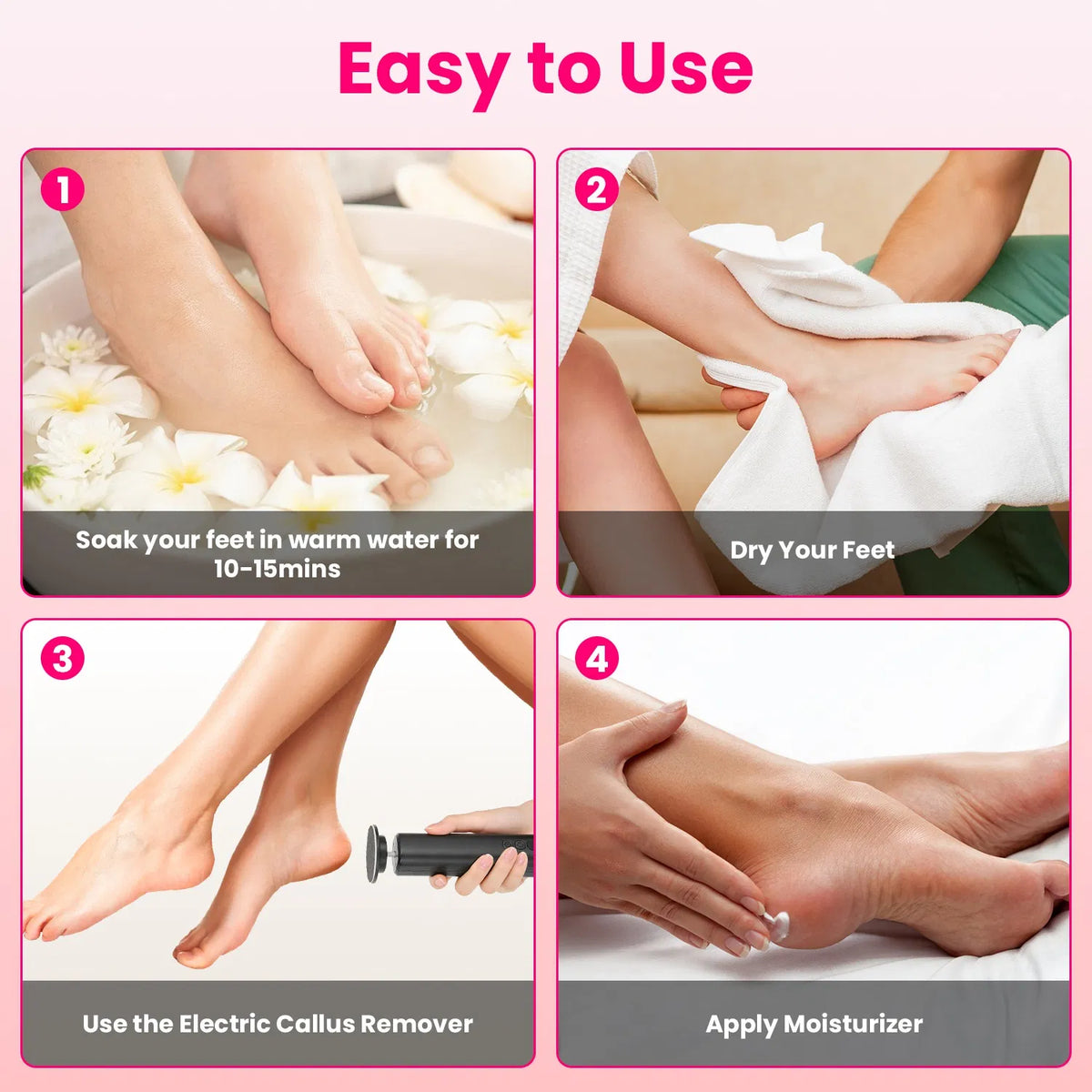 Electric Foot Callus Remover – Rechargeable Foot Care Tool