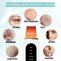 Ultrasonic Skin Scrubber – Electric Facial Skin Care Device